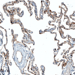 CD47 Antibody in Immunohistochemistry (Paraffin) (IHC (P))