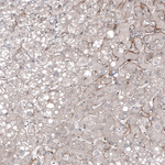 PSMA Antibody in Immunohistochemistry (Paraffin) (IHC (P))