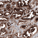 PSMA Antibody in Immunohistochemistry (Paraffin) (IHC (P))