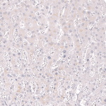 CD34 Antibody in Immunohistochemistry (Paraffin) (IHC (P))