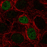 p53 Antibody in Immunocytochemistry (ICC/IF)
