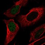 p53 Antibody in Immunocytochemistry (ICC/IF)