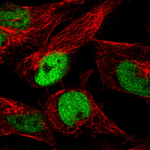 p53 Antibody in Immunocytochemistry (ICC/IF)