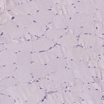 p53 Antibody in Immunohistochemistry (Paraffin) (IHC (P))