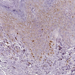 p53 Antibody in Immunohistochemistry (Paraffin) (IHC (P))