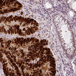 p53 Antibody in Immunohistochemistry (Paraffin) (IHC (P))