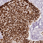 p53 Antibody in Immunohistochemistry (Paraffin) (IHC (P))