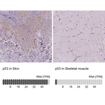 p53 Antibody in Immunohistochemistry (Paraffin) (IHC (P))