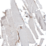 ITGA5 Antibody in Immunohistochemistry (Paraffin) (IHC (P))