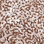 ITGA5 Antibody in Immunohistochemistry (Paraffin) (IHC (P))