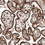 ITGA5 Antibody in Immunohistochemistry (Paraffin) (IHC (P))
