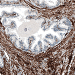 ITGA5 Monoclonal Antibody (CL6951)