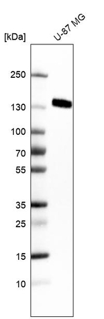 ITGA5 Antibody in Western Blot (WB)