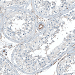 ITGA5 Antibody in Immunohistochemistry (Paraffin) (IHC (P))