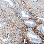 ITGA5 Antibody in Immunohistochemistry (Paraffin) (IHC (P))