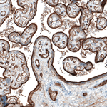 ITGA5 Antibody in Immunohistochemistry (Paraffin) (IHC (P))