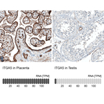 ITGA5 Antibody in Immunohistochemistry (Paraffin) (IHC (P))