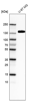 ITGA5 Antibody in Western Blot (WB)