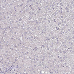 ErbB2 (HER-2) Antibody in Immunohistochemistry (Paraffin) (IHC (P))
