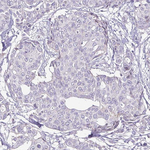 ErbB2 (HER-2) Antibody in Immunohistochemistry (Paraffin) (IHC (P))