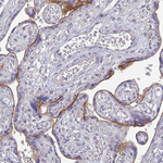 ErbB2 (HER-2) Antibody in Immunohistochemistry (Paraffin) (IHC (P))