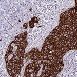 ErbB2 (HER-2) Antibody in Immunohistochemistry (Paraffin) (IHC (P))