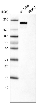 ErbB2 (HER-2) Antibody in Western Blot (WB)