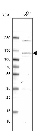 PMS1 Antibody in Western Blot (WB)
