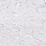 B3GAT1 Antibody in Immunohistochemistry (Paraffin) (IHC (P))