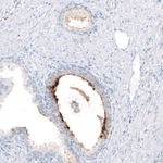 B3GAT1 Antibody in Immunohistochemistry (Paraffin) (IHC (P))