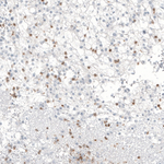 B3GAT1 Antibody in Immunohistochemistry (Paraffin) (IHC (P))