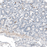 B3GAT1 Antibody in Immunohistochemistry (Paraffin) (IHC (P))