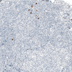 B3GAT1 Monoclonal Antibody (CL9500)