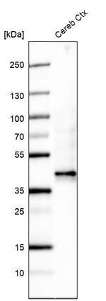 B3GAT1 Antibody in Western Blot (WB)