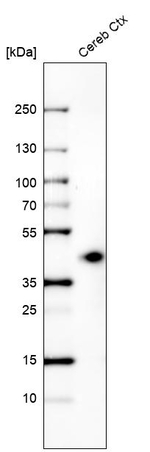 B3GAT1 Antibody in Western Blot (WB)