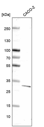 DKK1 Monoclonal Antibody (CL14707)