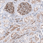 P2X7 Antibody in Immunohistochemistry (Paraffin) (IHC (P))