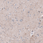 P2X7 Monoclonal Antibody (CL11508)