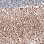 P2X7 Antibody in Immunohistochemistry (Paraffin) (IHC (P))