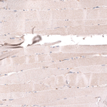CMPK2 Antibody in Immunohistochemistry (Paraffin) (IHC (P))