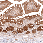 CMPK2 Antibody in Immunohistochemistry (Paraffin) (IHC (P))