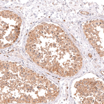 CMPK2 Monoclonal Antibody (CL14479)