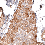 CMPK2 Antibody in Immunohistochemistry (Paraffin) (IHC (P))