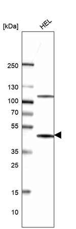 CMPK2 Antibody in Western Blot (WB)