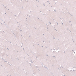 VMAT2 Antibody in Immunohistochemistry (Paraffin) (IHC (P))