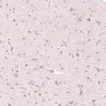 VMAT2 Monoclonal Antibody (CL13157)