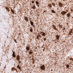 VMAT2 Antibody in Immunohistochemistry (Paraffin) (IHC (P))
