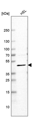VMAT2 Antibody in Western Blot (WB)
