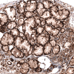 WNT5A Antibody in Immunohistochemistry (Paraffin) (IHC (P))