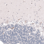 VMAT2 Antibody in Immunohistochemistry (Paraffin) (IHC (P))